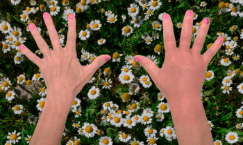 ¿Qué hacer cuando te pica una avispa?