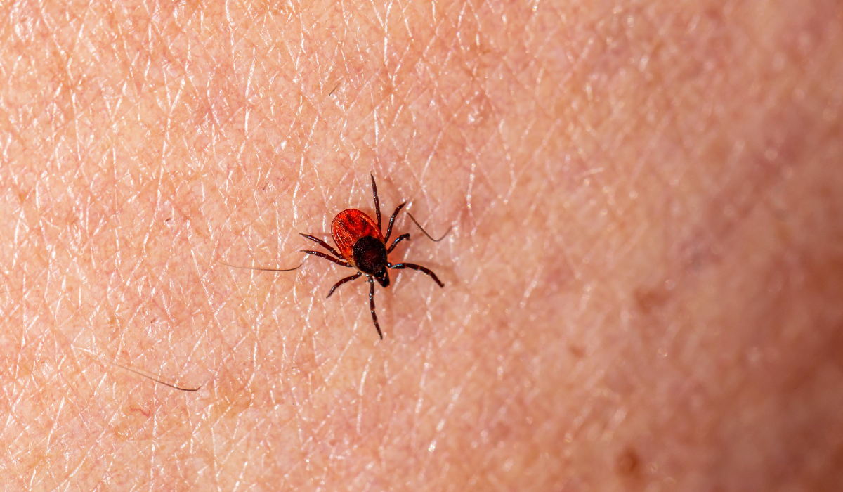 blog-enfermedad-de-lyme Una garrapata sobre la piel de una persona.