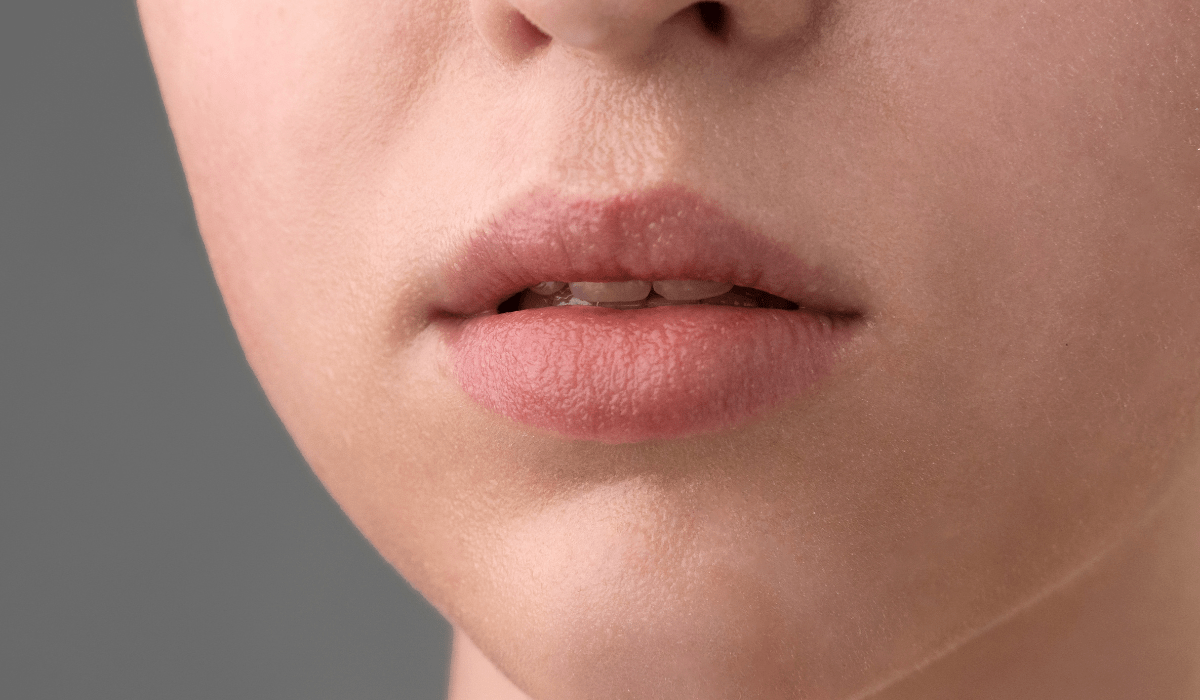 Labios secos, tips para mantenerlos hidratados