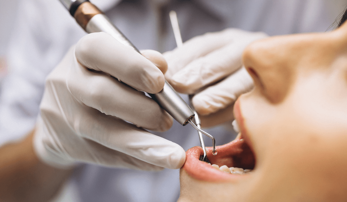 Periodontitis: síntomas y métodos de prevención Periodontitis: síntomas y métodos de prevención
