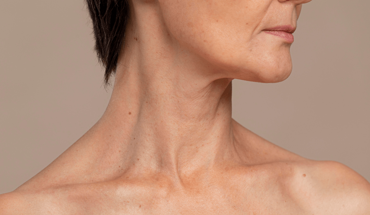 Arrugas en el cuello: causas y soluciones