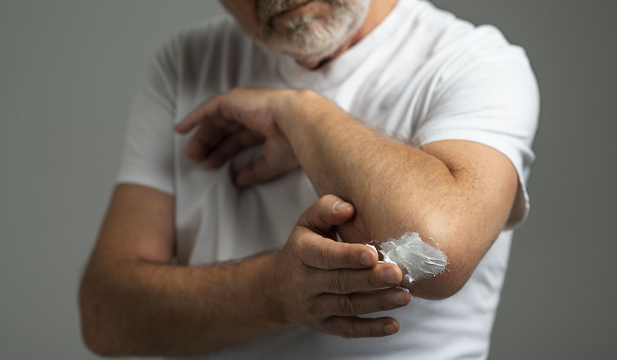 ¿Picaduras de mosquitos o medusas?